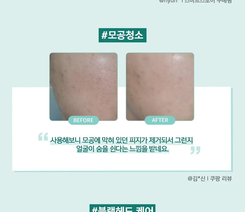 [민감성/여드름성피부적합] 테라비코스 엔자임 워싱 파우더 40g 상세페이지 40